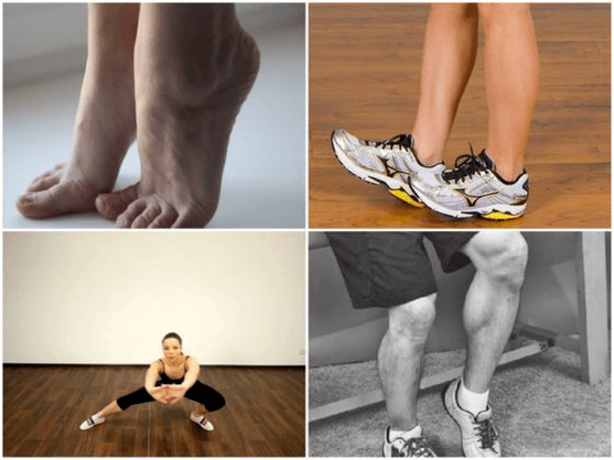 Krampfadern verursachen Beinschmerzen