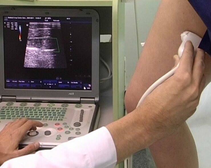 Ultraschalldiagnostik von Beckenvarizen