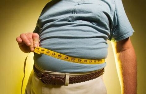 Übergewicht verursacht die Entstehung von Krampfadern