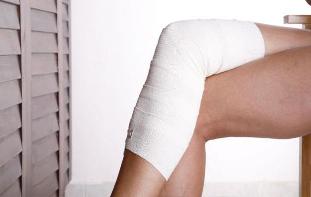 wie zur Behandlung von Krampfadern an den Beinen Verfahren